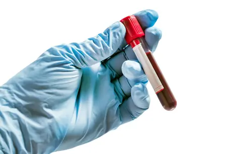 ALP Testi Nedir?