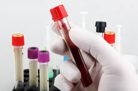 Beta HCG Değeri Nedir?