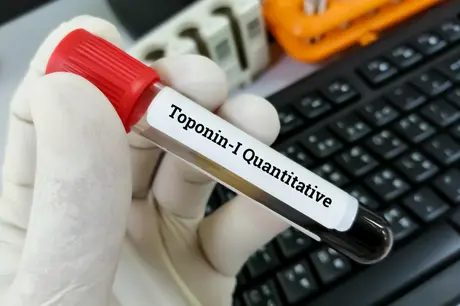Troponin Testi Nedir?